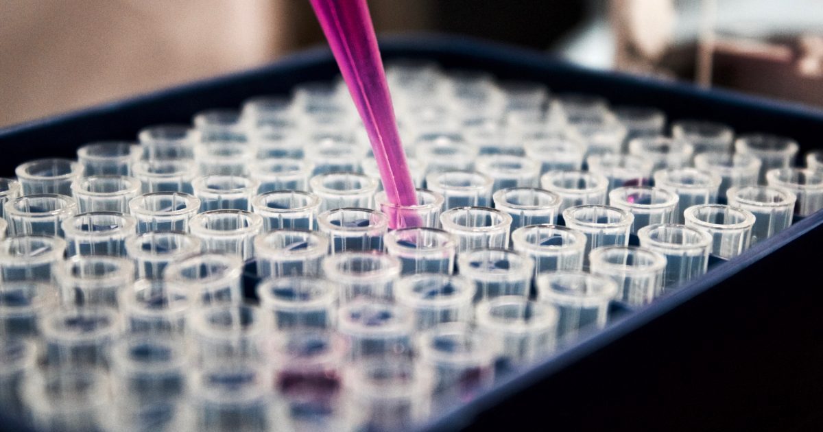 santaros-klinikose-atliktas-tyrimas-turi-buti-pakartotas-referentineje-laboratorijoje