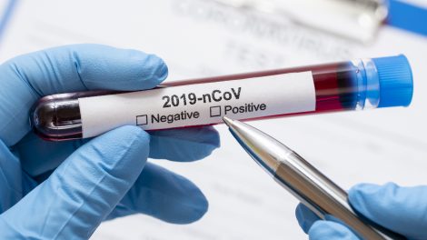 Šiuo metu Lietuvoje nustatyti 345 koronavirusine infekcija užsikrėtę asmenys