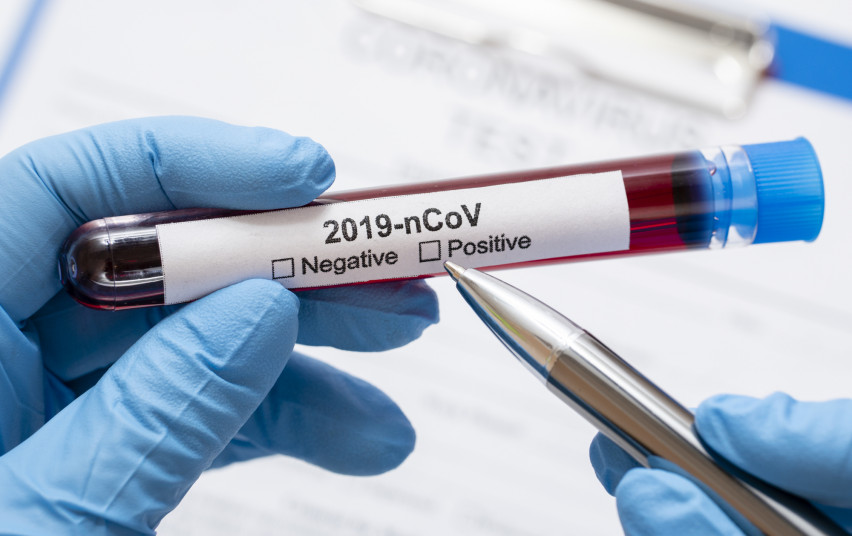 Per pirmadienį koronavirusinė infekcija nustatyta dar 7 asmenims