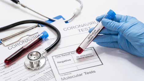 Rekomenduojama, kaip elgtis koronavirusinę infekciją nustačius ligoninėje