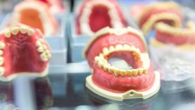 Dantų protezavimas – ką būtina žinoti prieš jį atliekant