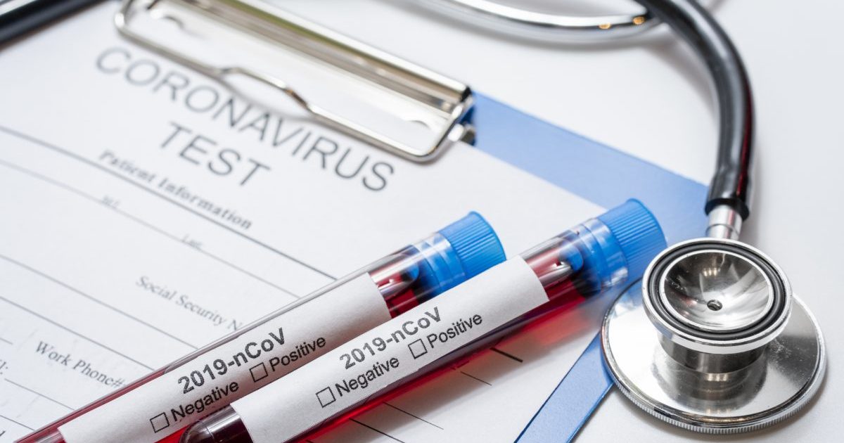 visu-praejusio-savaitgalio-prevenciniu-tyrimu-atsakymai-–-neigiami