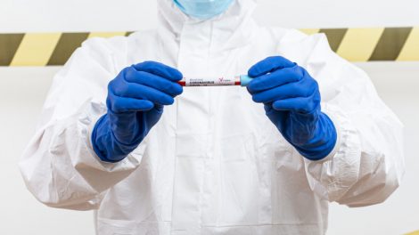 Patvirtinti 26 nauji užsikrėtimo koronavirusu atvejai: dauguma susiję su židiniais
