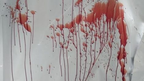 Pirmą kartą Lietuvoje pritaikytas kraujo pėdsakų rašto tyrimas, padėjo identifikuoti nužudymu įtariamą asmenį