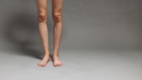 Ką daryti, kai tinsta kojos?