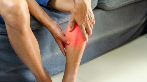 Kojų mėšlungis: Natūralios ir prevencinės priemonės skausmui malšinti