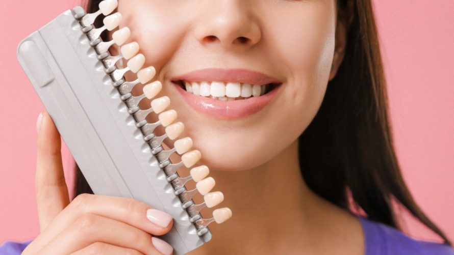 Balta šypsena – mitai ir tiesa apie dantų balinimą